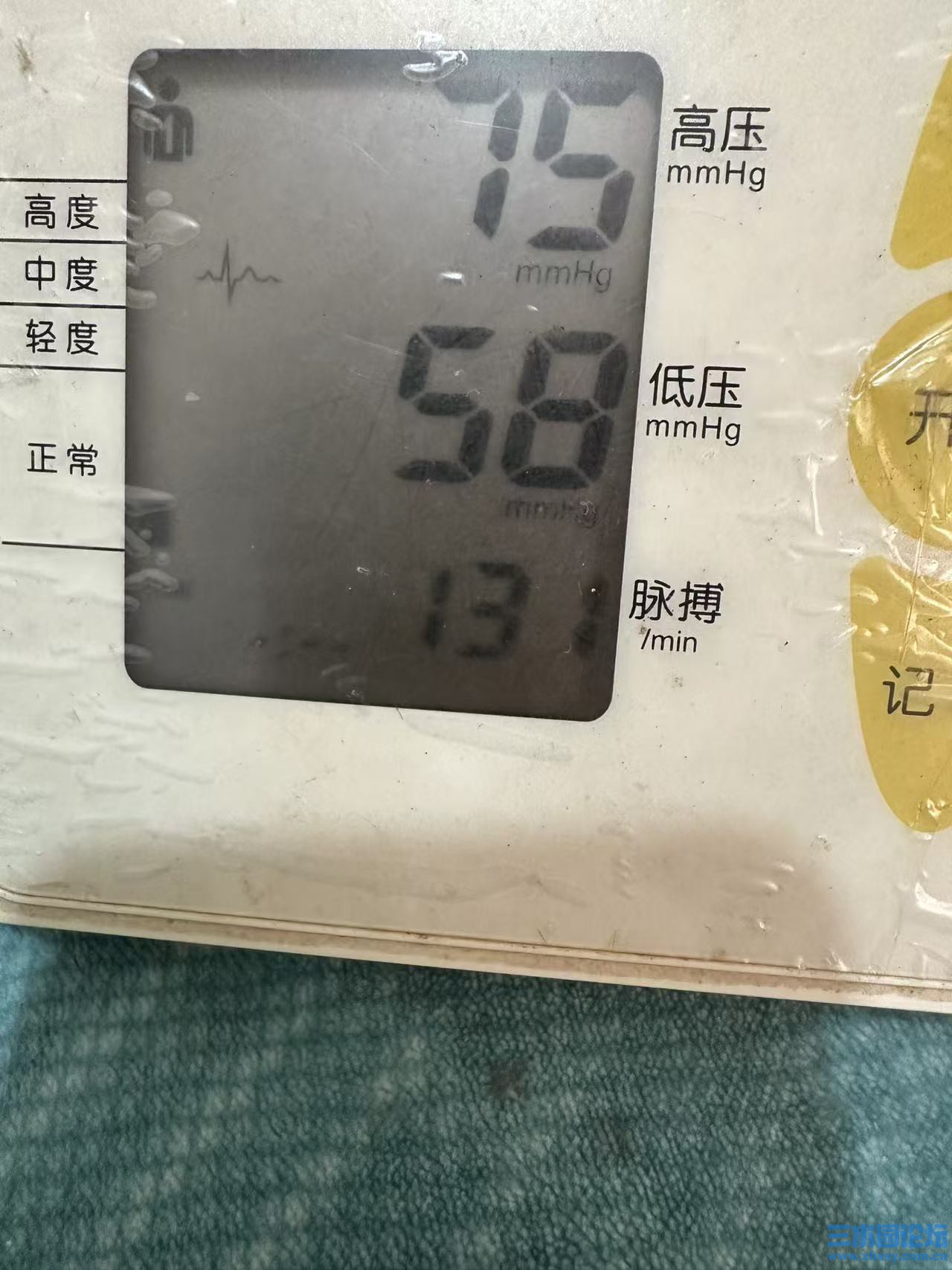 血压.jpg